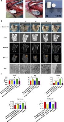 In vitro and in vivo Repair Effects of the NCF-Col-NHA Aerogel Scaffold Loaded With SOST Monoclonal Antibody and SDF-1 in Steroid-Induced Osteonecrosis